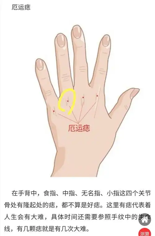 手背上这个地方长痣是不是真的不好?