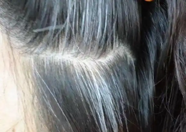 白发通常代表衰老,许多中老年人都有白色的头发,但一些年轻人也有白色