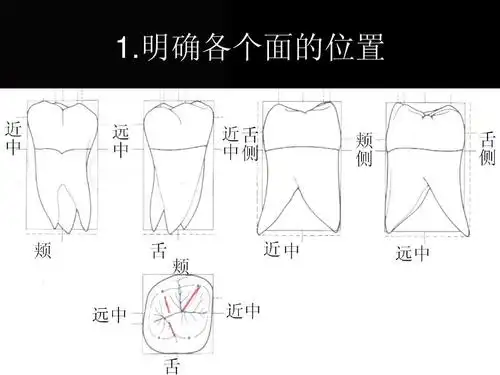 上颌第一磨牙的描绘ppt