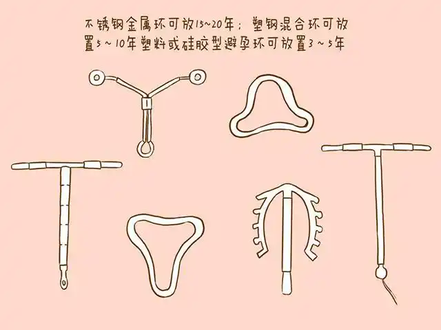 三角型号的节育环长什么样有图片吗