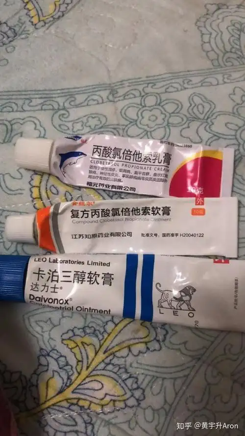 复方丙酸氯倍他索乳膏对牛皮癣有效果吗