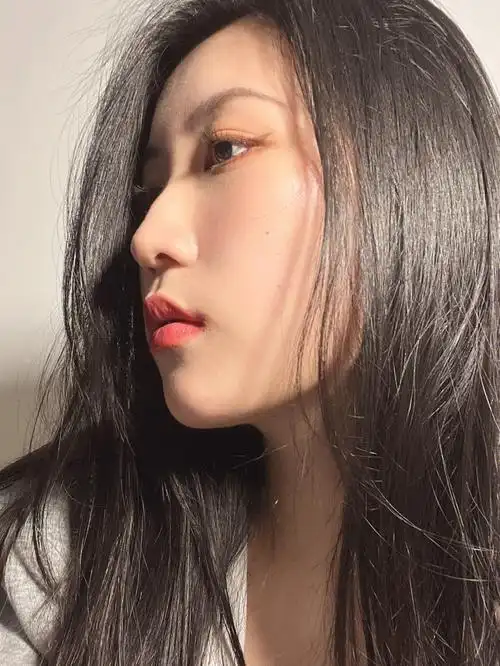 戴牙套一年终于拥有好看的侧脸