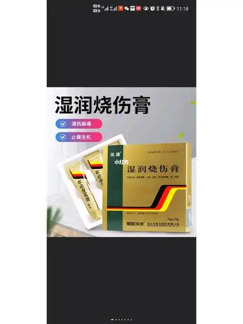 出美宝烫伤膏两支