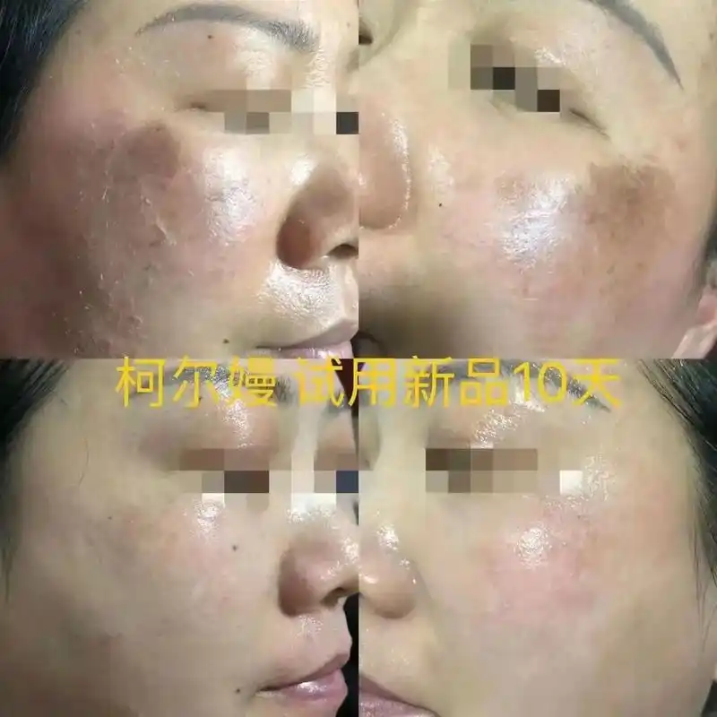 问题性皮肤管理 #告别肌肤问题 - 抖音