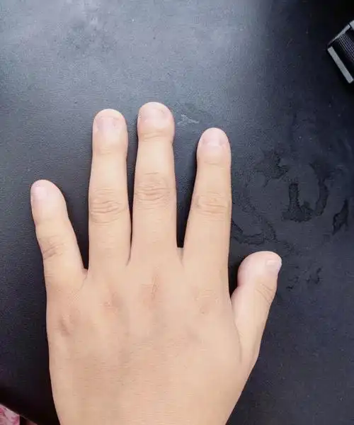 07这样的手指头真实存在嘛