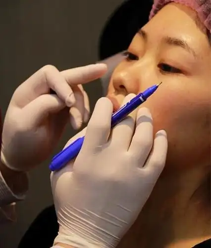 打玻尿酸10秒失明 揭秘打玻尿酸过程及真相内幕(图)