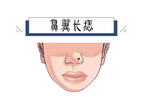 身体5颗破财痣,花钱大手大脚,吃上顿没下顿,手里没多少钱!