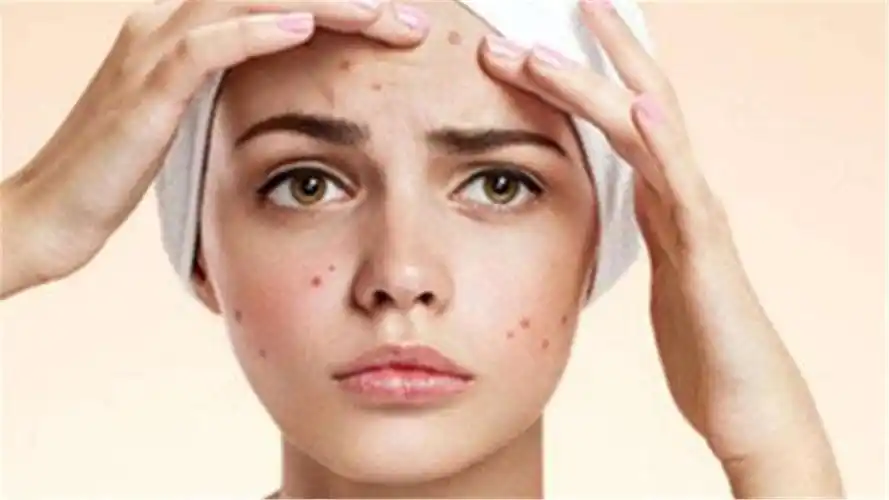 另一方面,皮肤缺水就会变得脆弱,皮脂腺就会分泌油脂来保护皮肤,锁住