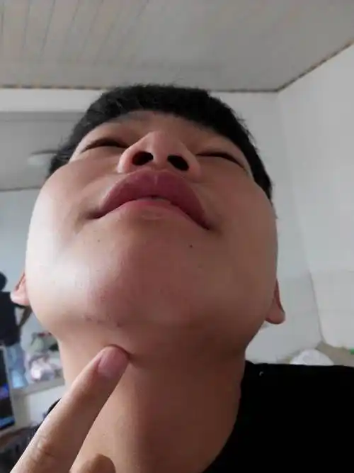 下巴的下颚骨上面有一点肿,摸到时候有疼痛感,怎么办啊!