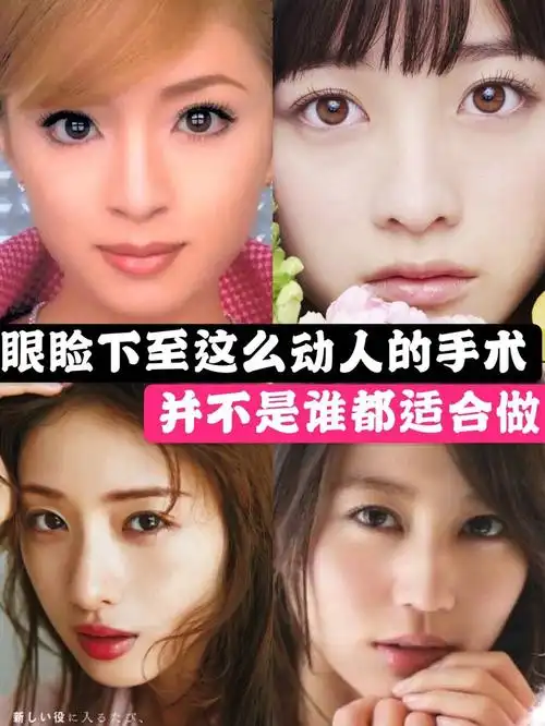 眼睑下至这么动人的手术,并不是谁都适合做