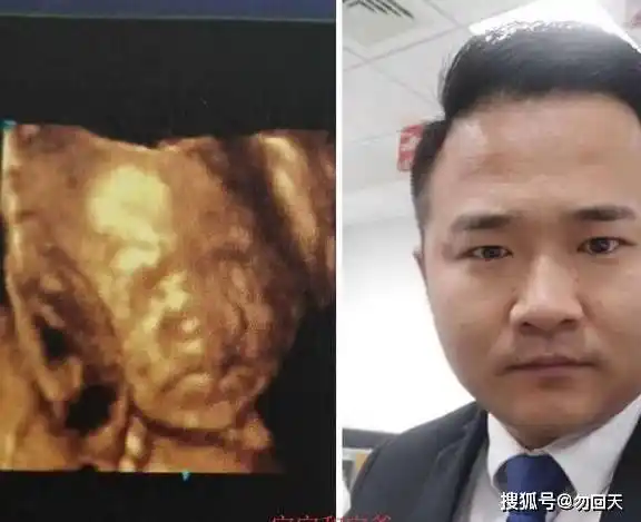 四维彩超宝宝鼻子大,知道四个原因,孕妈可以安心了_胎儿_检查_其他