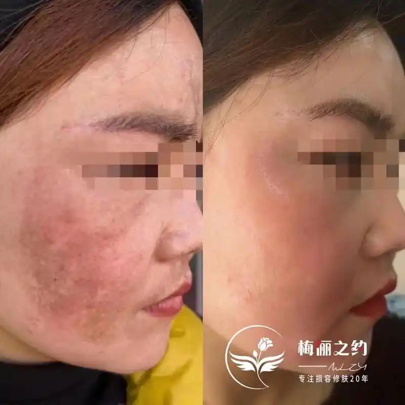 做祛斑所有的产品,都是围绕皮肤的修复去做,帮助皮肤完成自我修 - 抖