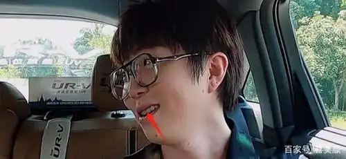 毛不易自爆想整容,这是开始行动了