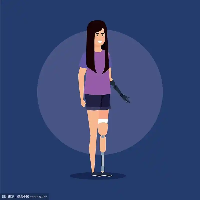 有手和腿假肢的残疾妇女