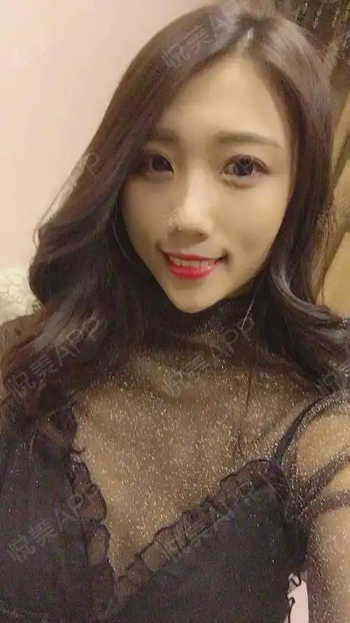 假体隆胸术后172天_隆胸术后172天_胸部整形术后172天_梵梵是个小仙女