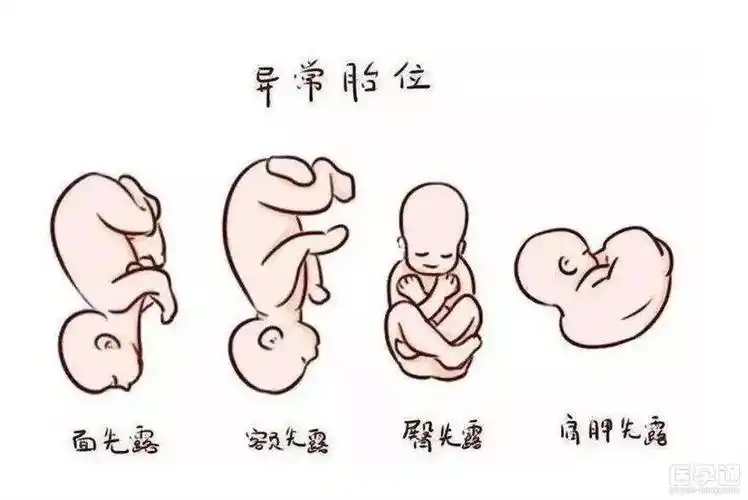 loa胎位在肚子里的图片分享,是好是坏一文知晓