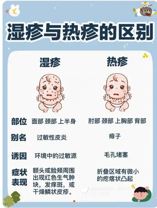 湿疹与热疹的区别