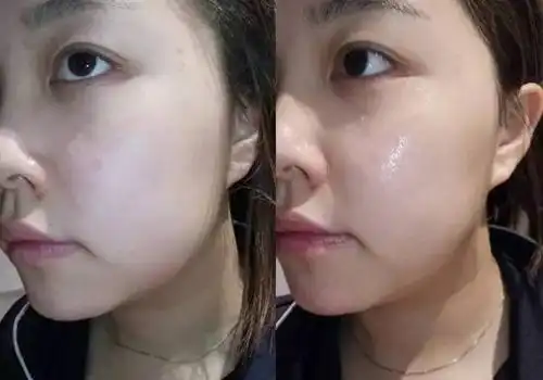 《花少》中江疏影最白皮肤状态no1?求夏日美白护肤秘籍啊!