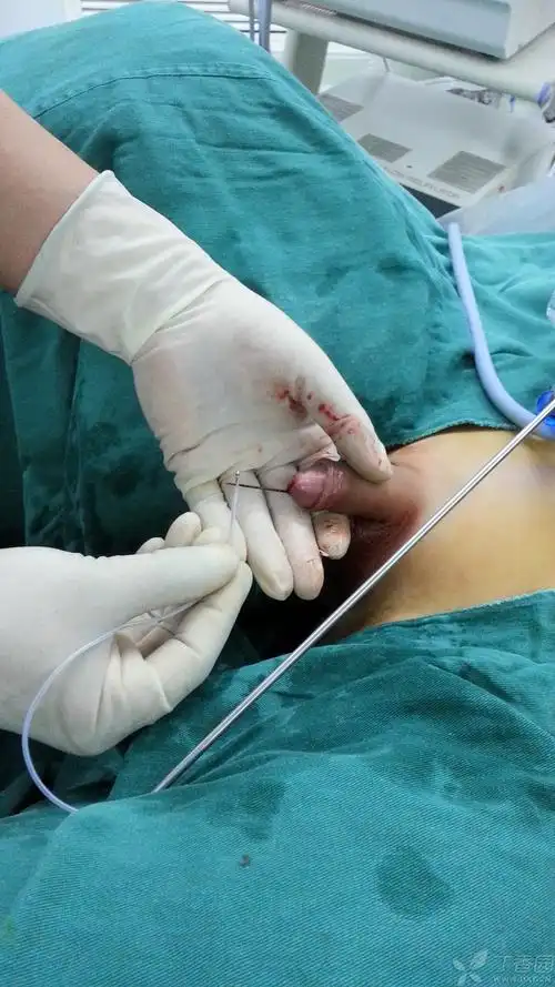 肾脏泌尿专业讨论版 -丁香园论坛