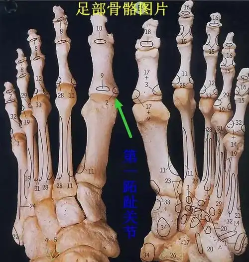 第一跖趾关节也就是足大拇指与脚掌的第一跖骨形成的关节,为了方便筋