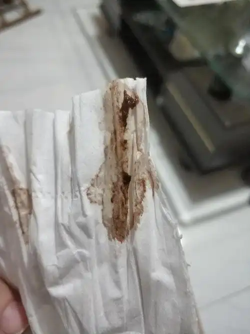 姐妹们 这个是排卵期出血吗(有图慎入)