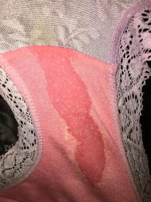 早上坐着感觉有股东西流出,不多,也没味道,肚子不疼,是破水吗?如图