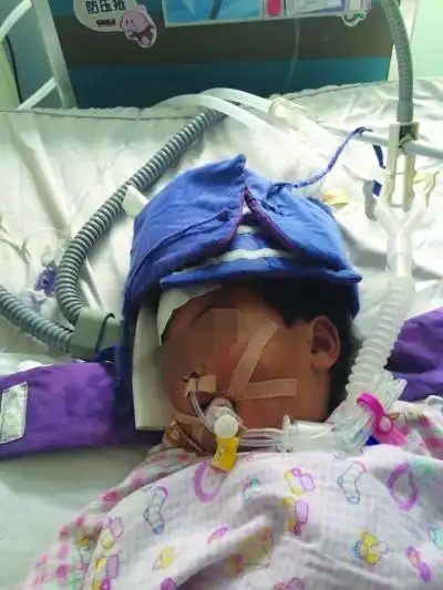 孩子,希望你能快点醒来 孩子仍在重症监护病房.薛马义 摄