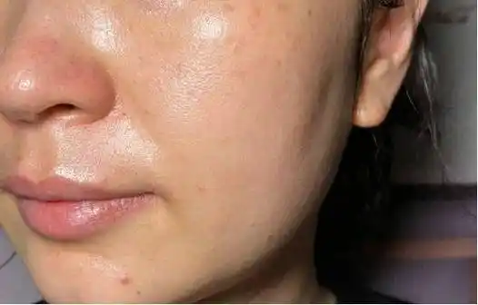 如何改善皮肤暗沉发黄?简单几个习惯,轻松提升颜值