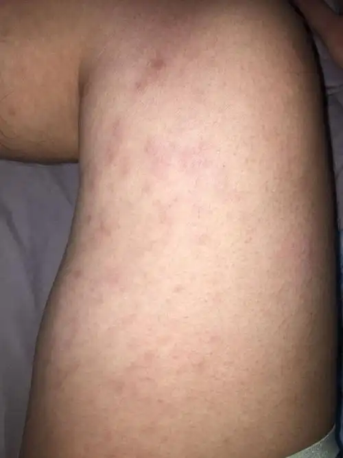 这是什么问题,一直这样有点黑黑的