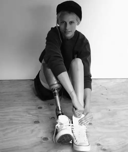 独腿妹子戴金色假肢在时装周首秀燃爆全场