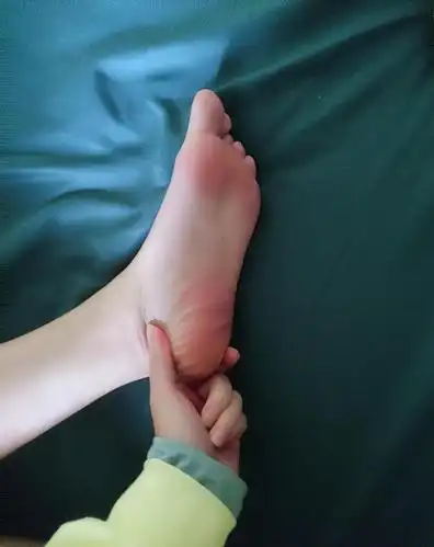 脚底板啥颜色粉色白色