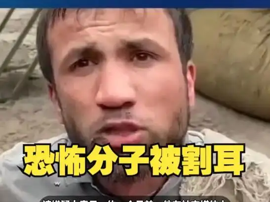 俄恐怖分子被割耳