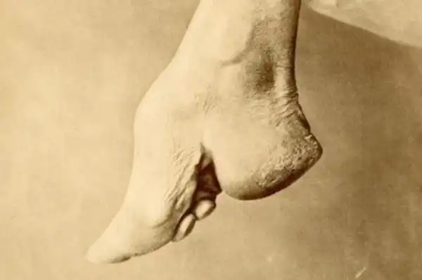 中国古代女人缠足这其中有什么缘由