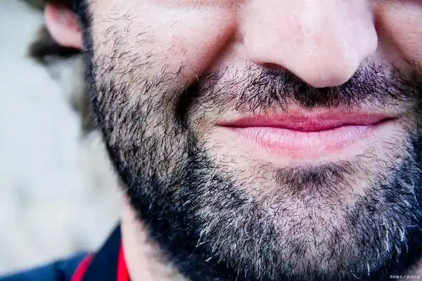 络腮胡子怎么去除