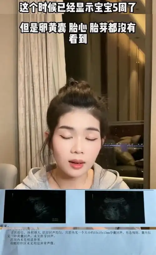 胎可能是空囊,医生建议清宫,细节让网友愤怒|胎心|辛巴|孕囊_网易订阅