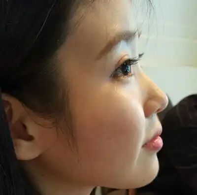 iu早期照图源:ins