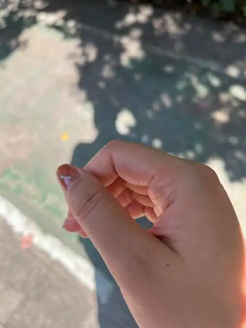 今天发现大拇指上方突然多了一颗痣