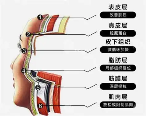 小切口提升和拉皮的区别在哪?为什么许多医生更建议拉皮?-非常爱美