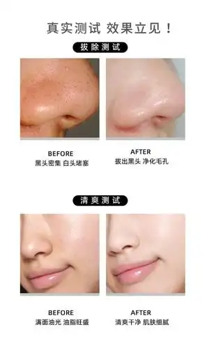 护肤小妙招奢悦撕拉清洁面膜净化毛孔去黑头温和不伤肤