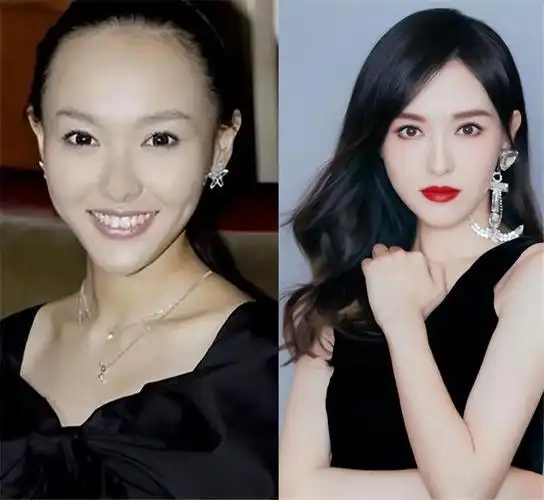 发际线是如何影响颜值的?看完这几组对比照之后,你就知道了