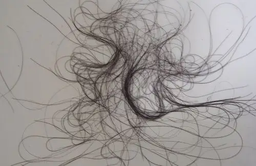 产后头发一抓一把的掉,医院检查才知因缺这种营养