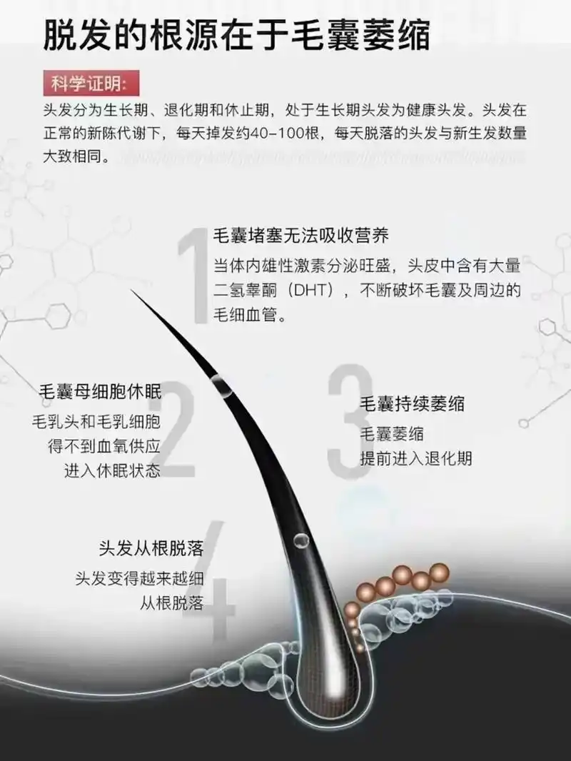 找对方法真的很重要.防脱生发必要三阶段 ①调理好头皮 ②激活 - 抖音
