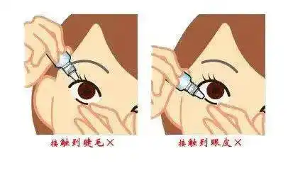 1ml;眼膏单次通常用量为1-1.5cm,即大约半个指节的长度.