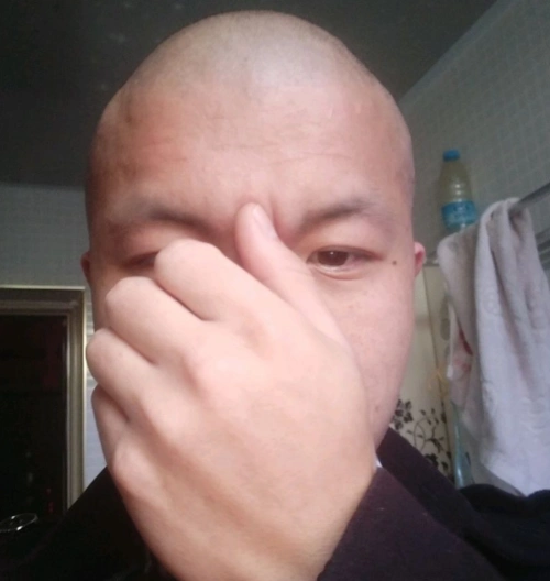 安吉男子不小心理了光头,却有另一番效果!社友说像这明星