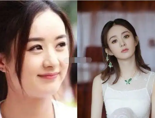 女明星减肥前后对比,躲过了赵丽颖,躲过了赵露思,却被她沦陷了