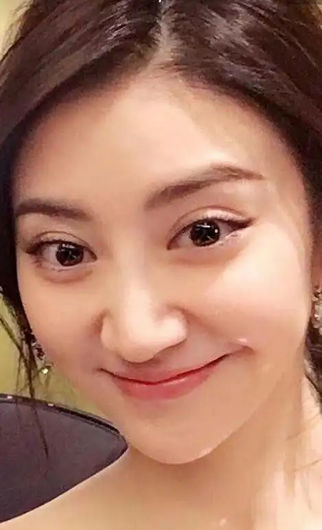 99还记得戚薇刚刚出道时是圆脸,单眼皮,和现在对比来_圈子-新氧美容