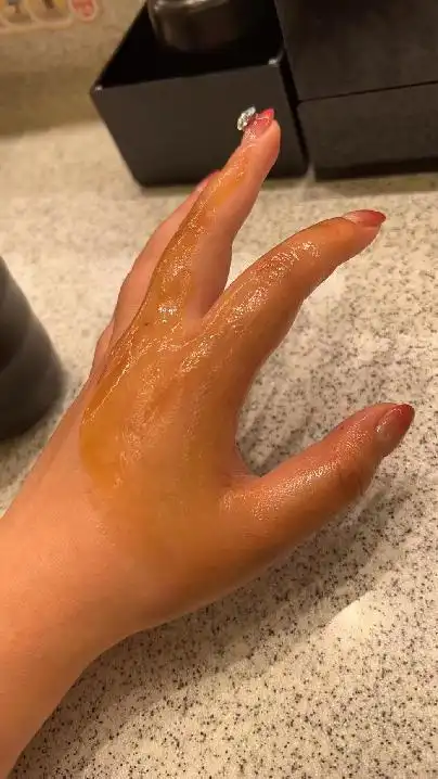 女子在饭店就餐被烫伤,索赔千元!店家这么说