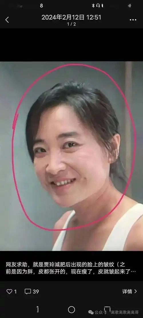 减肥后贾玲脸上的"皱纹",不用医美,能否消除._底部_什么_页面