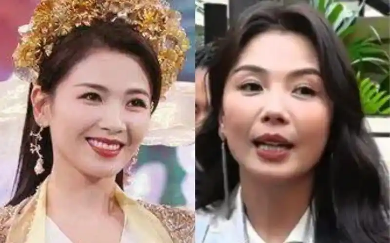 刘涛的脸怎么了?