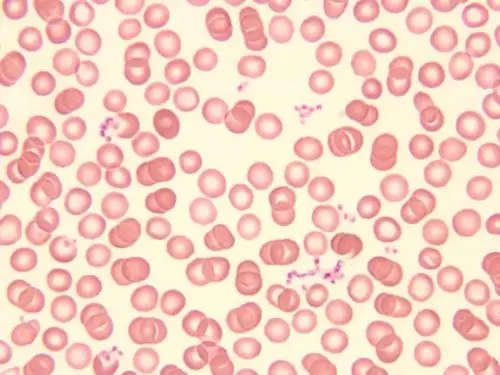 图为正常红细胞